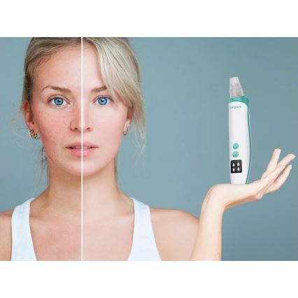 Beper - Аккумуляторный очиститель пор USB/5V 400 mAh