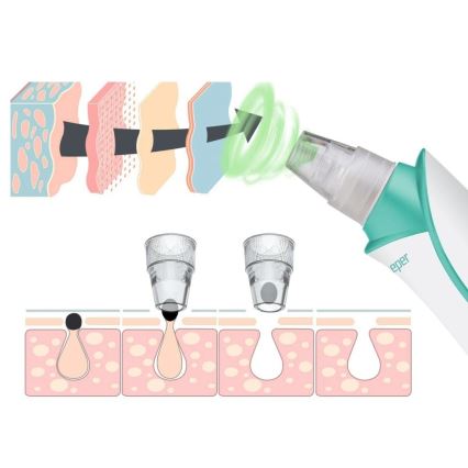 Beper - Аккумуляторный очиститель пор USB/5V 400 mAh